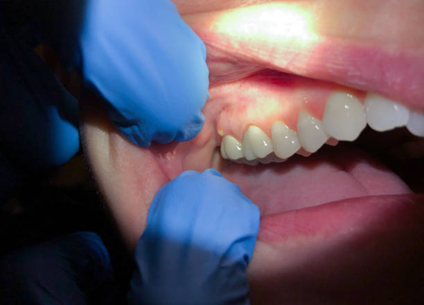 Best Urgent Tooth Repair  in Richland, MS