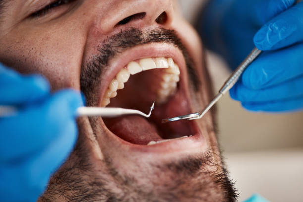 Best Broken Tooth Emergency  in Richland, MS